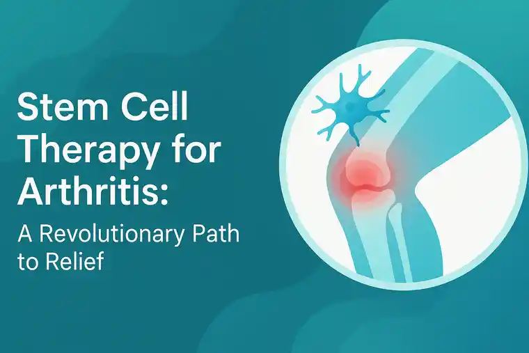 Stem Cell Therapy for Arthritis A Revolutionary Path to Relief